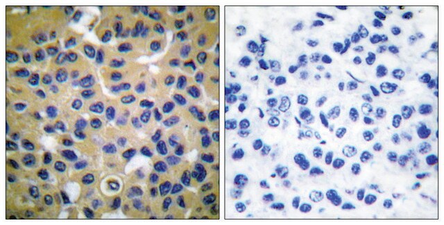 Anti-Collagen II antibody produced in rabbit affinity isolated antibody