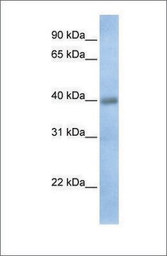 Anti-TXNDC15 antibody produced in rabbit affinity isolated antibody