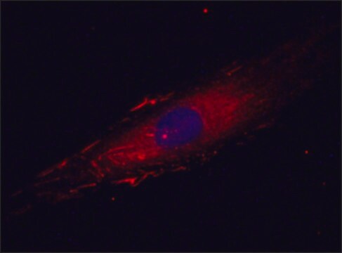 Anti-Fibronectin antibody, Mouse monoclonal clone FN-15, purified from hybridoma cell culture