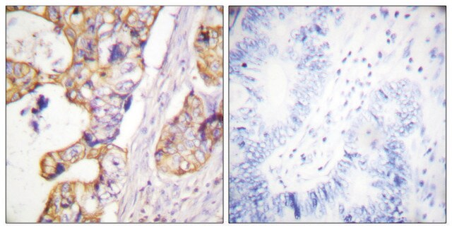 Anti-Keratin 8 antibody produced in rabbit affinity isolated antibody