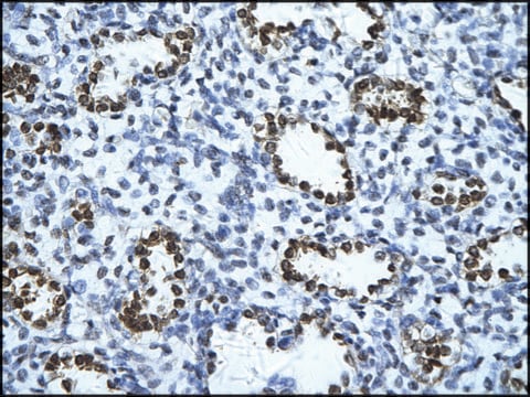 Anti-ENO1 (AB1) antibody produced in rabbit IgG fraction of antiserum