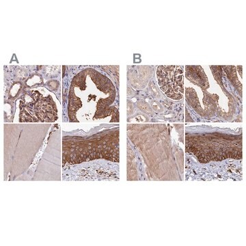 Anti-TNKS1BP1 antibody produced in rabbit Prestige Antibodies&#174; Powered by Atlas Antibodies, affinity isolated antibody, buffered aqueous glycerol solution