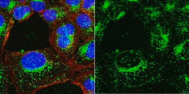 Anti-LAMP-1 Antibody, clone H4A3 clone H4A3, from mouse