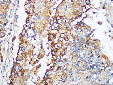 Anti-Carbonic Anhydrase 9 (CA9/G250) antibody produced in rabbit