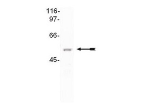 Anti-CUGBP2 Antibody, clone 1H2 clone 1H2, Upstate&#174;, from mouse