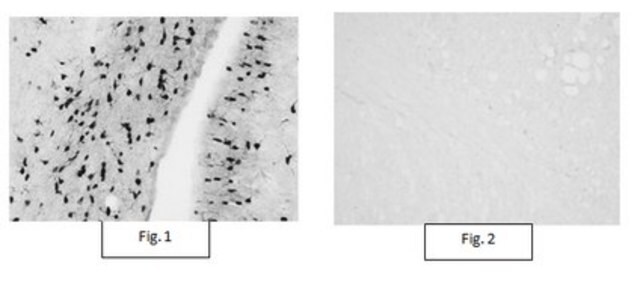 Anti-Aspa/Nur7 Antibody from rabbit, purified by affinity chromatography