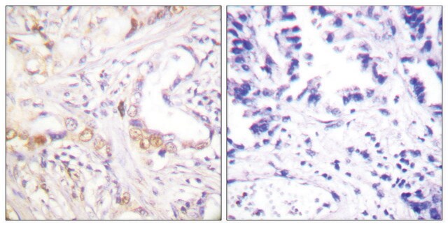 Anti-PIAS3 antibody produced in rabbit affinity isolated antibody