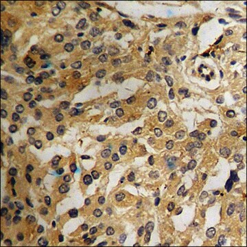 Anti-phospho-CD4 (pSer433) antibody produced in rabbit affinity isolated antibody