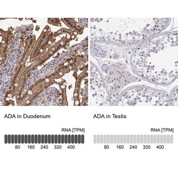 Anti-ADA antibody produced in rabbit Prestige Antibodies&#174; Powered by Atlas Antibodies, affinity isolated antibody, buffered aqueous glycerol solution