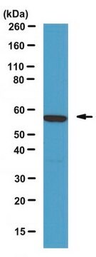 Anti-Calcineurin A&#945; Antibody from rabbit, purified by affinity chromatography