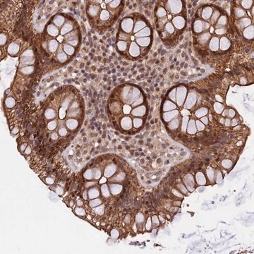 Anti-ARL14EP antibody produced in rabbit Prestige Antibodies&#174; Powered by Atlas Antibodies, affinity isolated antibody, buffered aqueous glycerol solution