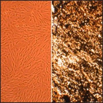 Human Osteoblasts: HOb, adult