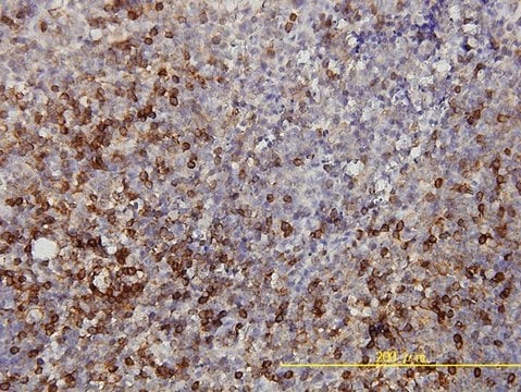 Monoclonal Anti-LDHB antibody produced in mouse clone 2H6, purified immunoglobulin, buffered aqueous solution