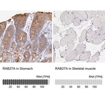 Anti-RAB27A antibody produced in rabbit Prestige Antibodies&#174; Powered by Atlas Antibodies, affinity isolated antibody, buffered aqueous glycerol solution