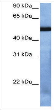 Anti-TBX19 antibody produced in rabbit affinity isolated antibody