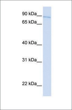 Anti-TBX2 antibody produced in rabbit affinity isolated antibody