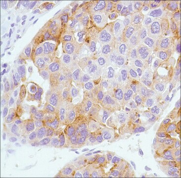 Anti-Alpha-Fetoprotein antibody, Rabbit monoclonal recombinant, expressed in proprietary host, clone SP154, affinity isolated antibody