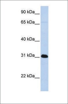 Anti-PADI4 antibody produced in rabbit affinity isolated antibody