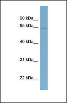 Anti-EYA1 antibody produced in rabbit affinity isolated antibody