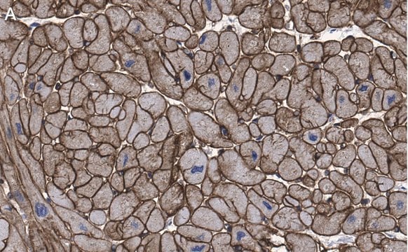 Anti-Laminin B2 Antibody, clone 1B9 ZooMAb&#174; Rabbit Monoclonal recombinant, expressed in HEK 293 cells