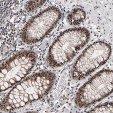 Anti-SURF6 antibody produced in rabbit Prestige Antibodies&#174; Powered by Atlas Antibodies, affinity isolated antibody, buffered aqueous glycerol solution