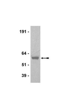 Anti-Akt1/PKB&#945; Antibody, clone AW24, rabbit monoclonal clone AW24, Upstate&#174;, from rabbit