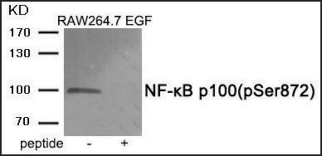 Anti-phospho-NF-&#954;B p100 (pSer872) antibody produced in rabbit affinity isolated antibody