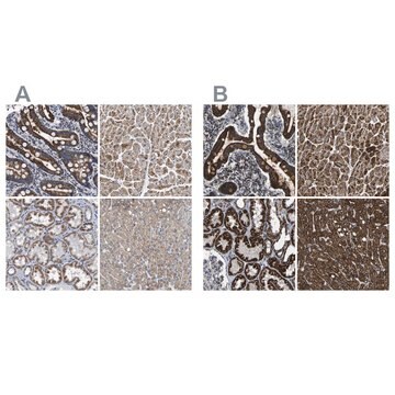 Anti-ETFA antibody produced in rabbit Prestige Antibodies&#174; Powered by Atlas Antibodies, affinity isolated antibody, buffered aqueous glycerol solution