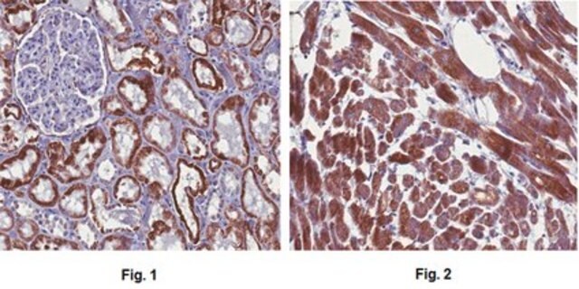 Anti-APC Antibody, CT, clone C-APC Antibody 28.9, Ascites Free clone C-APC 28.9, from mouse