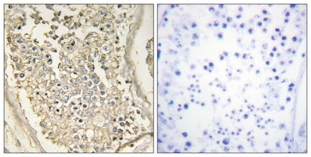 Anti-ATP7B antibody produced in rabbit affinity isolated antibody