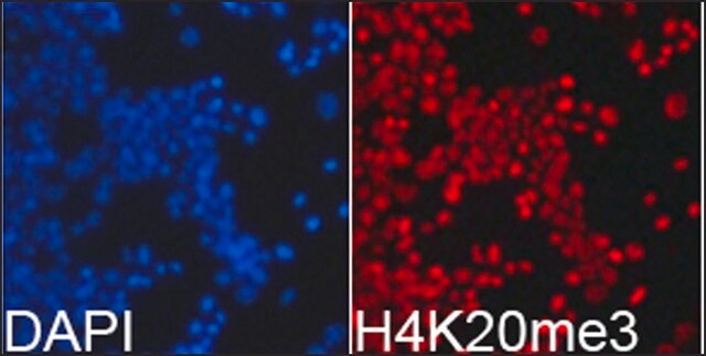 Anti-Histone H4K20me3 antibody produced in rabbit affinity isolated antibody