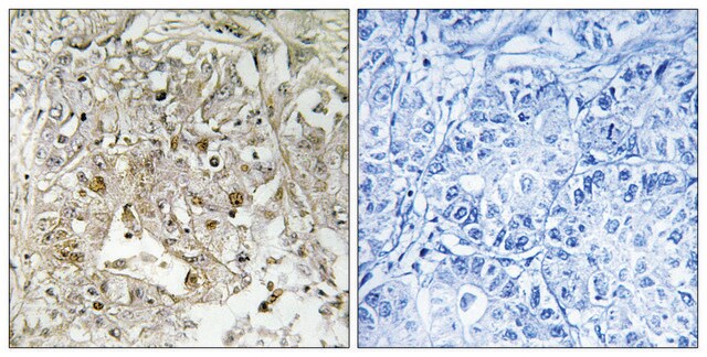 Anti-p38 MAPK antibody produced in rabbit affinity isolated antibody