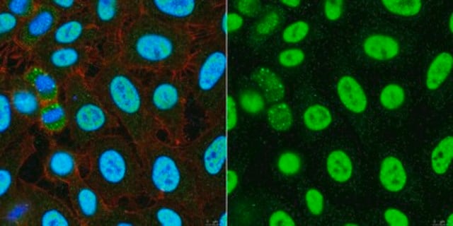 Anti-Nurr1 (NR4A2) from rabbit, purified by affinity chromatography