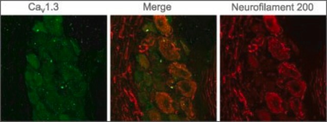 Anti-Calcium Channel (&#945;1D Subunit) (L-type of Voltage-gated Ca2+ Channel) antibody produced in rabbit affinity isolated antibody, lyophilized powder