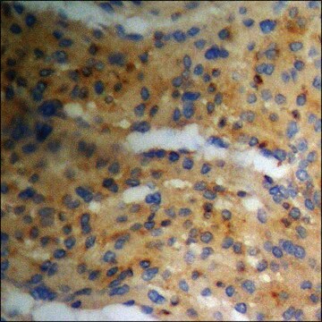 Anti-phospho-PKA CAT (pThr197) antibody produced in rabbit affinity isolated antibody