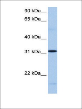 Anti-FUSIP1 (AB2) antibody produced in rabbit affinity isolated antibody