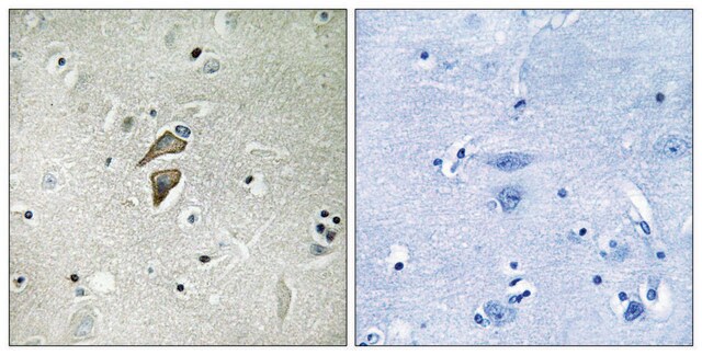 Anti-RNF149 antibody produced in rabbit affinity isolated antibody