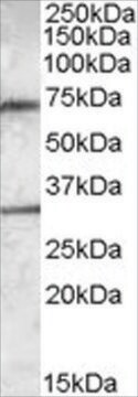 Anti-Endothelial Lipase antibody produced in goat affinity isolated antibody, buffered aqueous solution