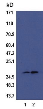 RalB Activation Assay Kit (non-radioactive) Non-radioactive Ral-B Activation Assay Kit can be used to precipitate Ral-B-GTP from cell lysates &amp; detection by a Ral-B specific monoclonal antibody.