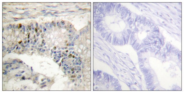 Anti-Histone H1 antibody produced in rabbit affinity isolated antibody