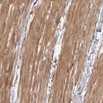 Anti-ZCCHC11 antibody produced in rabbit Prestige Antibodies&#174; Powered by Atlas Antibodies, affinity isolated antibody, buffered aqueous glycerol solution