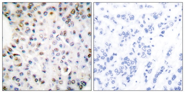 Anti-Retinoid X Receptor &#947; antibody produced in rabbit affinity isolated antibody