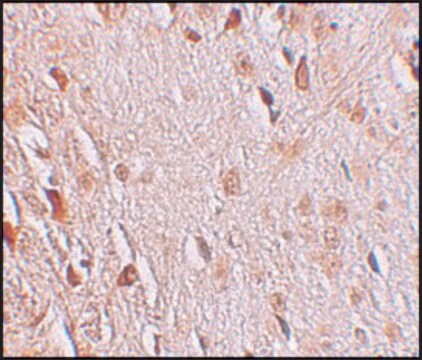 Anti-WIZ antibody produced in rabbit affinity isolated antibody, buffered aqueous solution