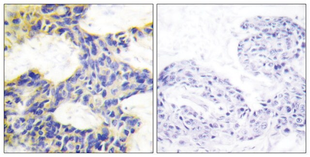 Anti-S6K antibody produced in rabbit affinity isolated antibody