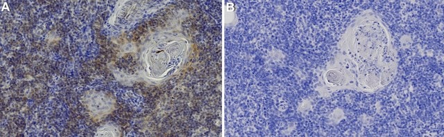 Anti-CD261/DR4 Antibody, clone 1B7 ZooMAb&#174; Rabbit Monoclonal recombinant, expressed in HEK 293 cells