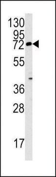 ANTI-REX1 (ZFP42)(N-TERMINAL) antibody produced in rabbit IgG fraction of antiserum, buffered aqueous solution