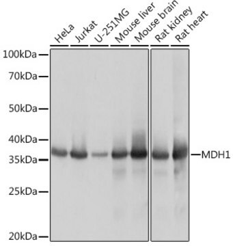 Anti-MDH1 Antibody, clone 8U9X1, Rabbit Monoclonal