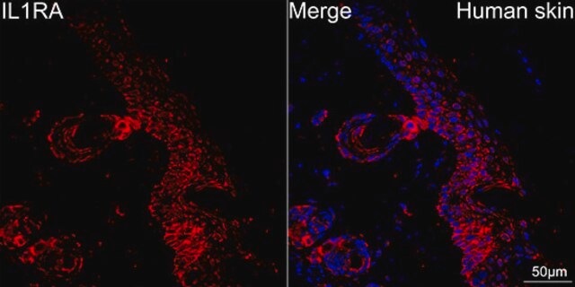 Anti-IL1RA Antibody, clone 4V9E1, Rabbit Monoclonal