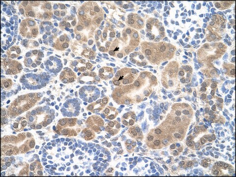 Anti-SLC38A1 (AB1) antibody produced in rabbit IgG fraction of antiserum