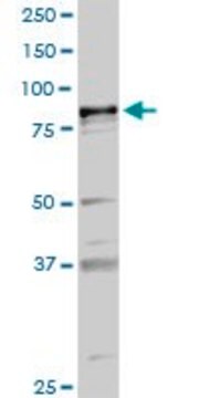 Anti-PLA2G6 antibody produced in rabbit purified immunoglobulin, buffered aqueous solution